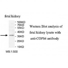 COPS6 Antibody