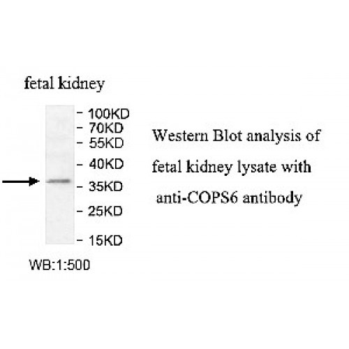 COPS6 Antibody