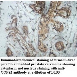 COPS5 Antibody