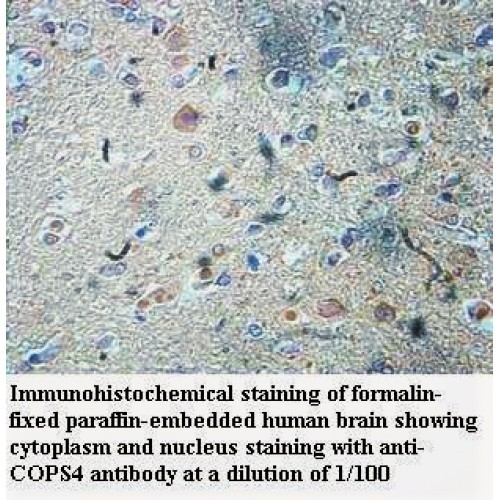 COPS4 Antibody