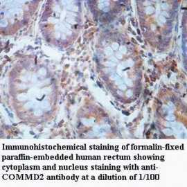 COMMD2 Antibody