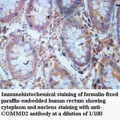 COMMD2 Antibody