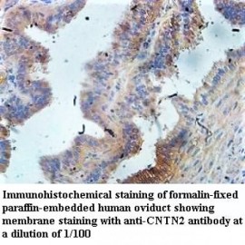 CNTN2 Antibody
