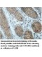 CNKSR2 Antibody