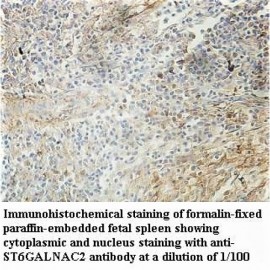 ST6GALNAC2 Antibody
