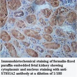 ST8SIA2 Antibody
