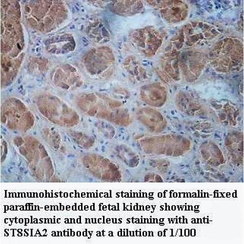 ST8SIA2 Antibody