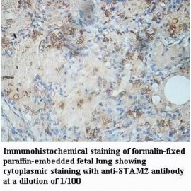 STAM2 Antibody