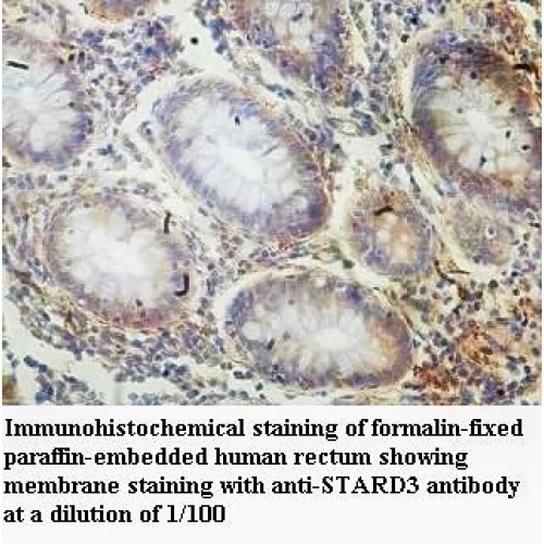 STARD3 Antibody