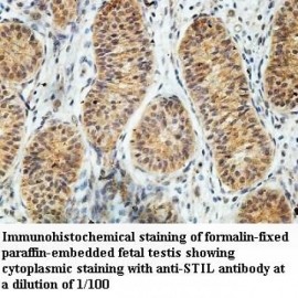 STIL Antibody