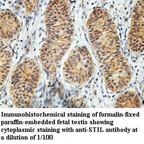 STIL Antibody