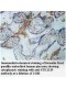 STK11IP Antibody