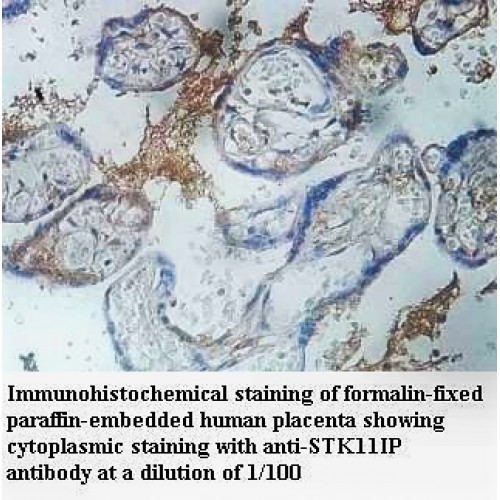STK11IP Antibody