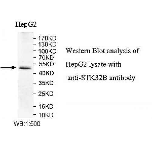 STK32B Antibody