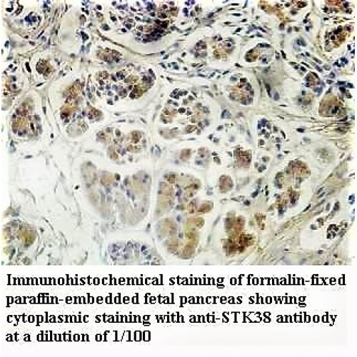 STK38 Antibody
