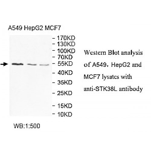 STK38L Antibody