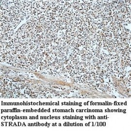 STRADA Antibody