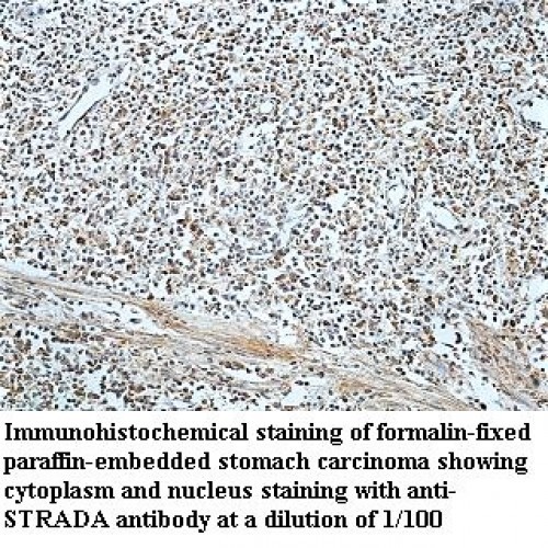 STRADA Antibody