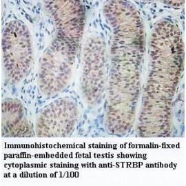 STRBP Antibody