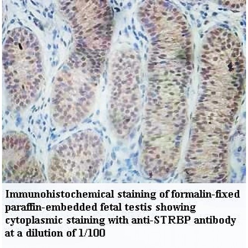 STRBP Antibody