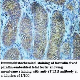 STT3B Antibody
