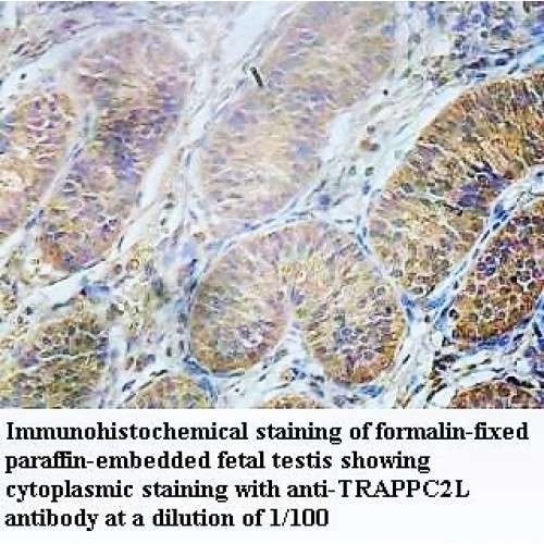 TRAPPC2L Antibody