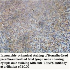 TRAF5 Antibody