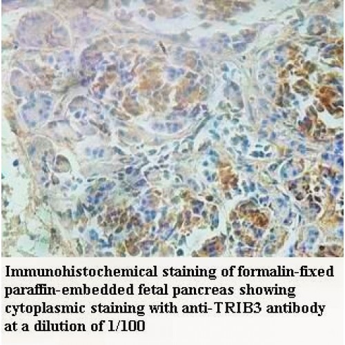 TRIB3 Antibody