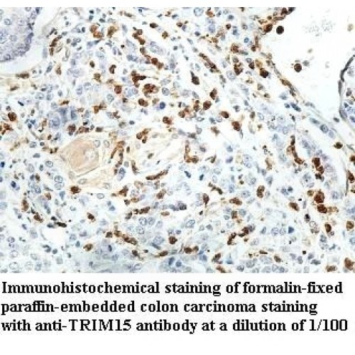 TRIM15 Antibody