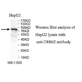 TRIM2 Antibody