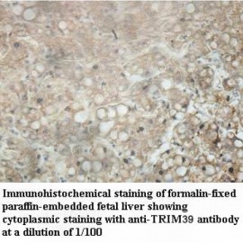 TRIM39 Antibody