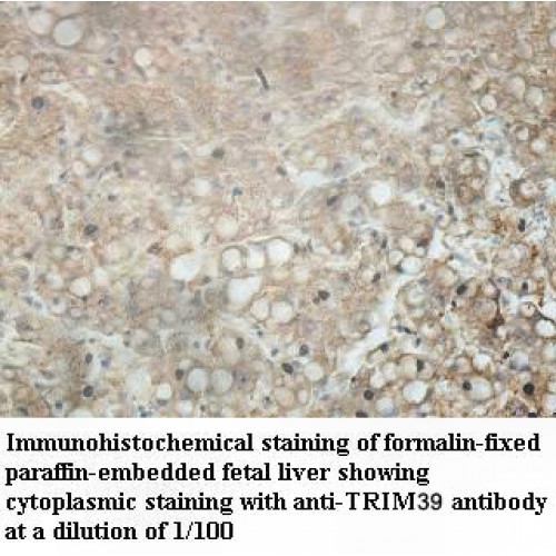TRIM39 Antibody