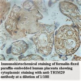 TRIM29 Antibody