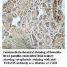 TRIM35 Antibody
