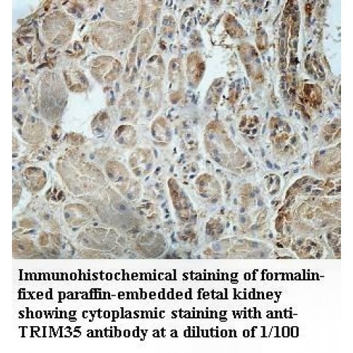 TRIM35 Antibody