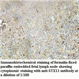 STX11 Antibody