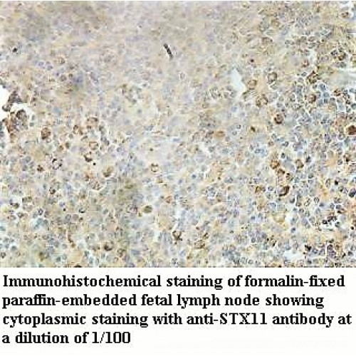 STX11 Antibody