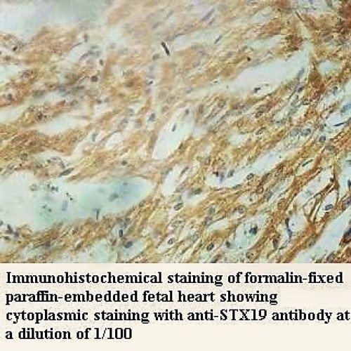 STX19 Antibody