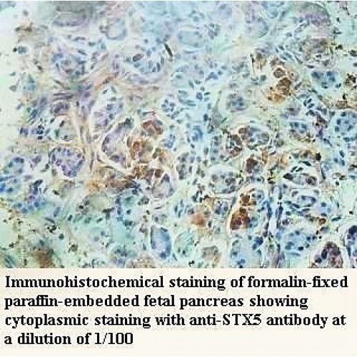 STX5 Antibody