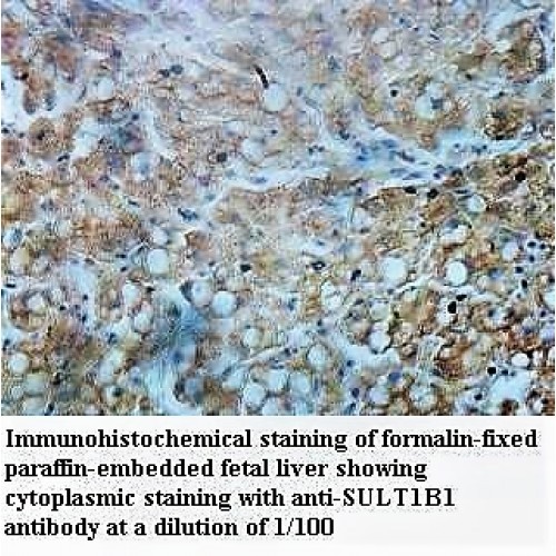 SULT1B1 Antibody