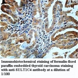SULT1C4 Antibody