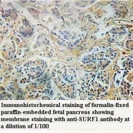 SURF1 Antibody
