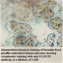 KLHL20 Antibody