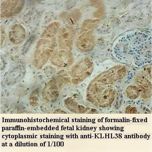 KLHL38 Antibody