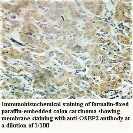 OSBP2 Antibody