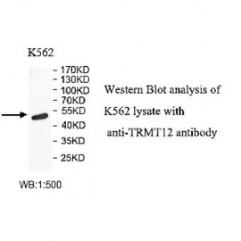 TRMT12 Antibody