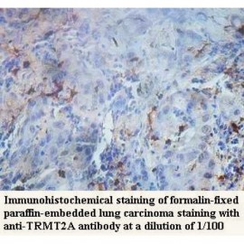 TRMT2A Antibody