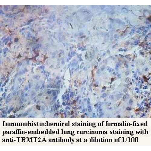 TRMT2A Antibody