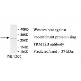 TRMT2B Antibody