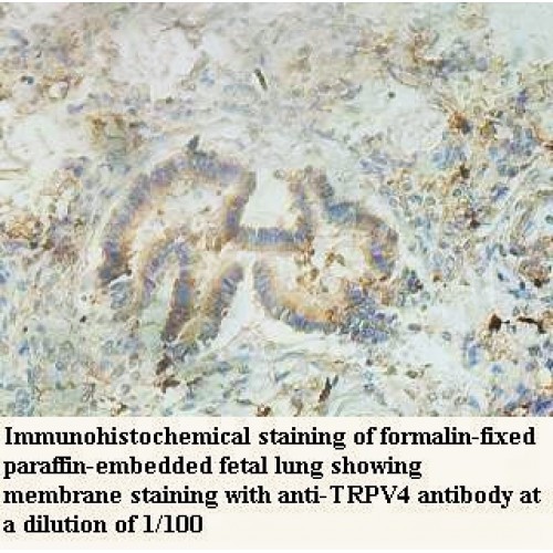 TRPV4 Antibody